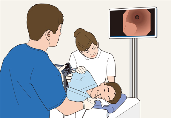 胃カメラ検査のイラスト